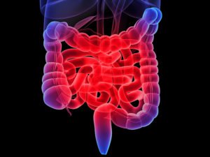 GI CANCER