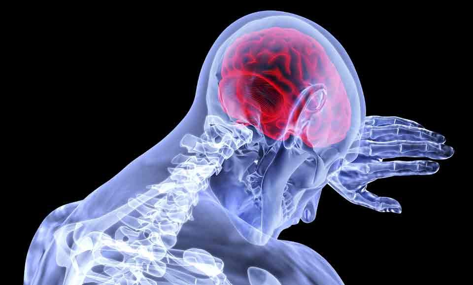 multiple sclerosis