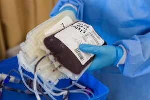 plasma therapy