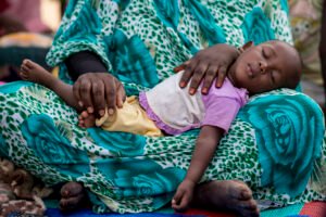 Child Malnutrition