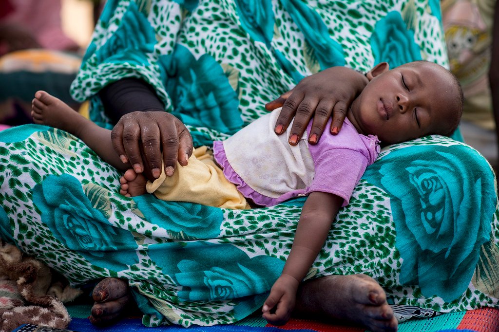 Child Malnutrition