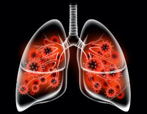 Lungs