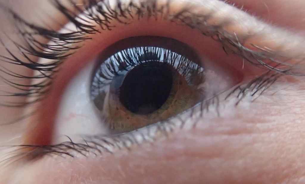 Infants and children with glaucoma typically also have different signs and symptoms than adults.