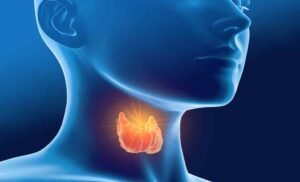 Ayurvedic Solutions for Thyroid Problems: Introducing Thyro Care and Kanchnaar Guggulu