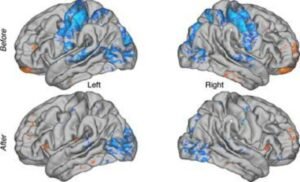 New Study Uncovers How Consistent Meditation Alters Brain Connectivity