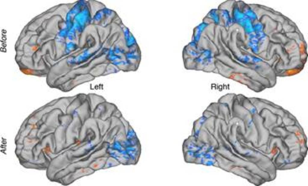 New Study Uncovers How Consistent Meditation Alters Brain Connectivity