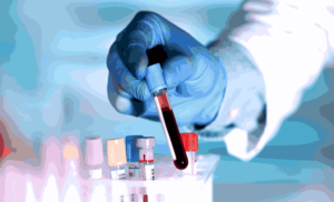 According to reports released by the United Nations, as of 2023, 40 million individuals around the globe found themselves grappling with the HIV crisis.