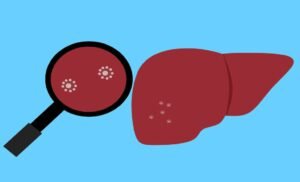 World Hepatitis Day 2022: Global Initiative to Tackle the Growing Burden of Hepatitis