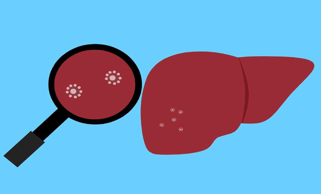 World Hepatitis Day 2022: Global Initiative to Tackle the Growing Burden of Hepatitis