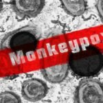 Monkeypox Outbreak Raises Concerns for Vulnerable Populations, WHO Urges Heightened Surveillance