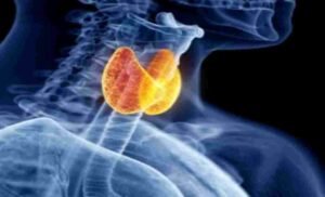 CK Birla Hospital Utilizes Advanced NIFI Technology for Successful Thyroid Surgery