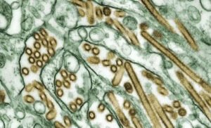 Marburg Virus Disease