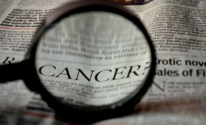 The diagnosis of colorectal cancers is made by doing serum tumour marker-CEA, lower GI endoscopy or ultrasonogram endoscopy and biopsy.