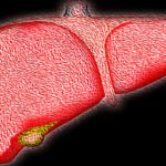 Among all, fatty liver is a prevalent health condition