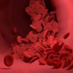 Stress can exacerbate the symptoms of Thalassaemia