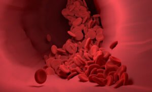 Stress can exacerbate the symptoms of Thalassaemia