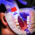 The study said that denture can lead to pneumonia if not cleaned properly.