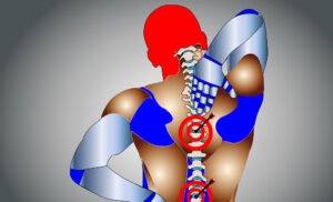 The analysis revealed that individuals with fibromyalgia faced a 27 percent higher risk of death from all causes over time.