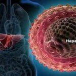 Nevertheless, this study is the largest and most representative of its kind.