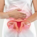Ovarian Cancer: Symptoms and Preventive Actions