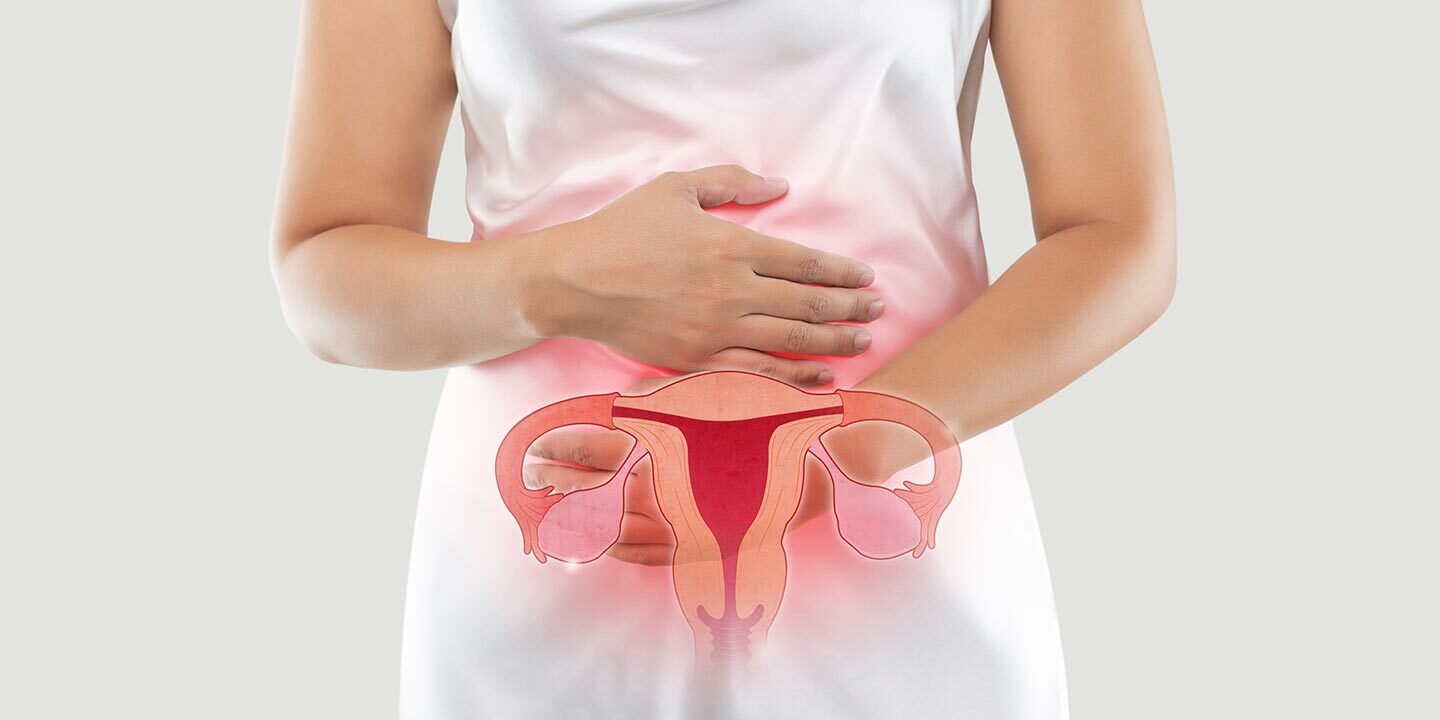 Ovarian Cancer: Symptoms and Preventive Actions