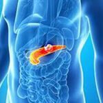 In the case of pancreatic cancer, the tumor is usually formed at the head of the pancreas.