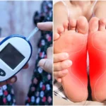 Diabetes Symptoms In Women: Diabetic Foot and 4 Other Warning Signs of High Blood Sugar