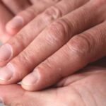 Fragile or Grooved Nails