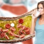 High Cholesterol Management