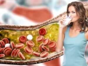 High Cholesterol Management