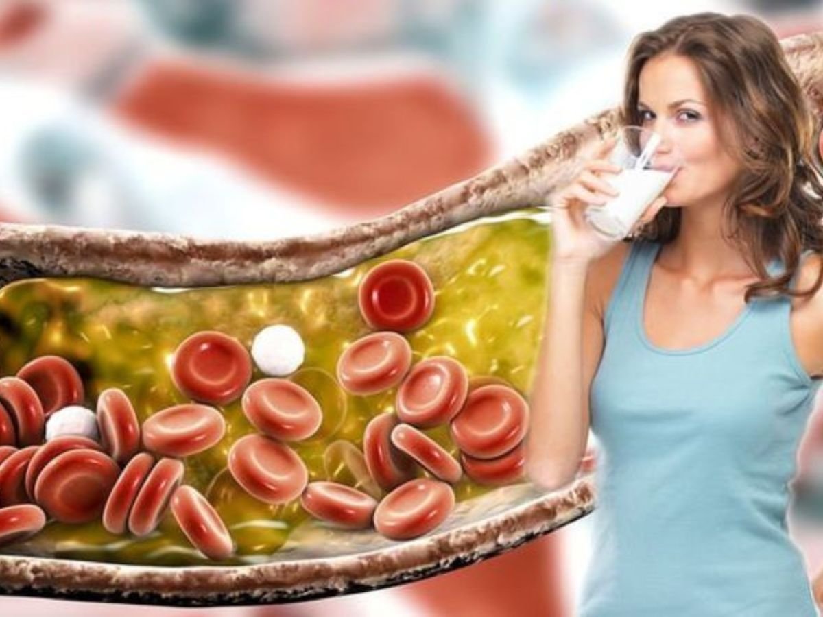 High Cholesterol Management