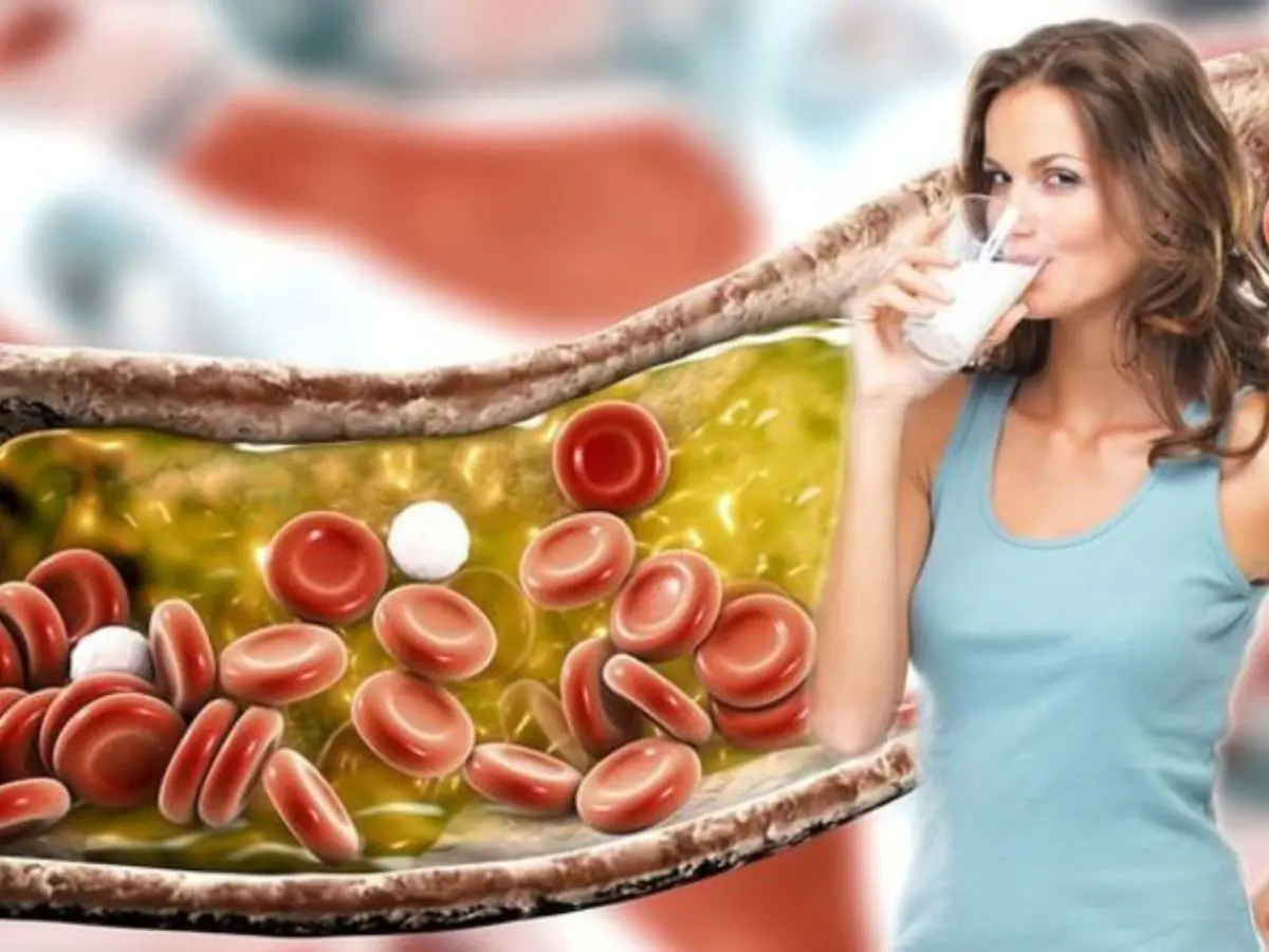 High Cholesterol Management