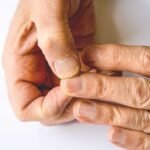 Nails Shaped Like Spoons