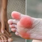 Signs of Vitamin B12 Deficiency