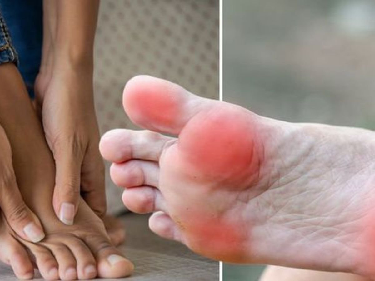 Signs of Vitamin B12 Deficiency