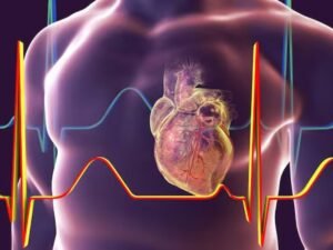 Stroke Prevention Tips