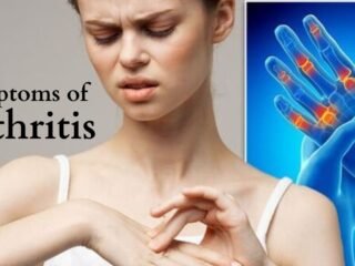 Arthritis