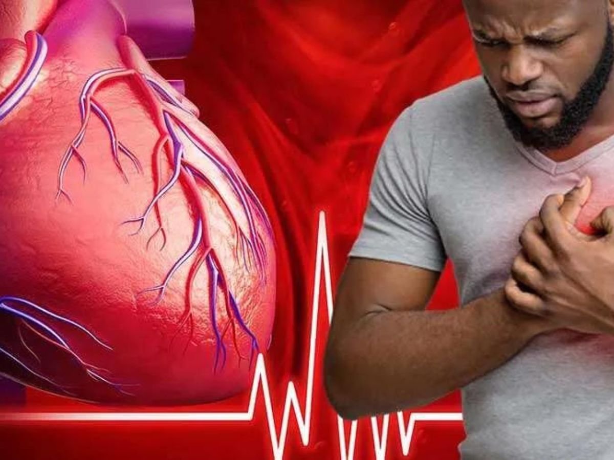 Heart Attack
