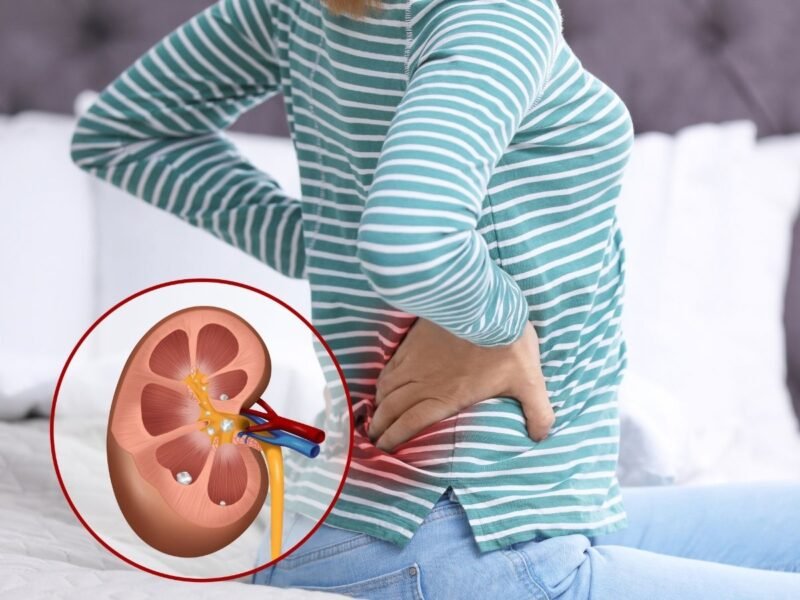 Kidney Damage Symptoms