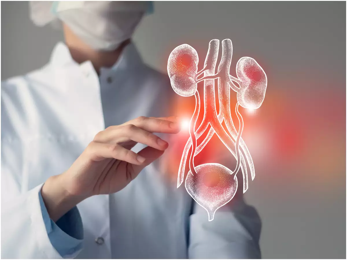 Top 5 Home Remedies To Treat Kidney Stones Naturally