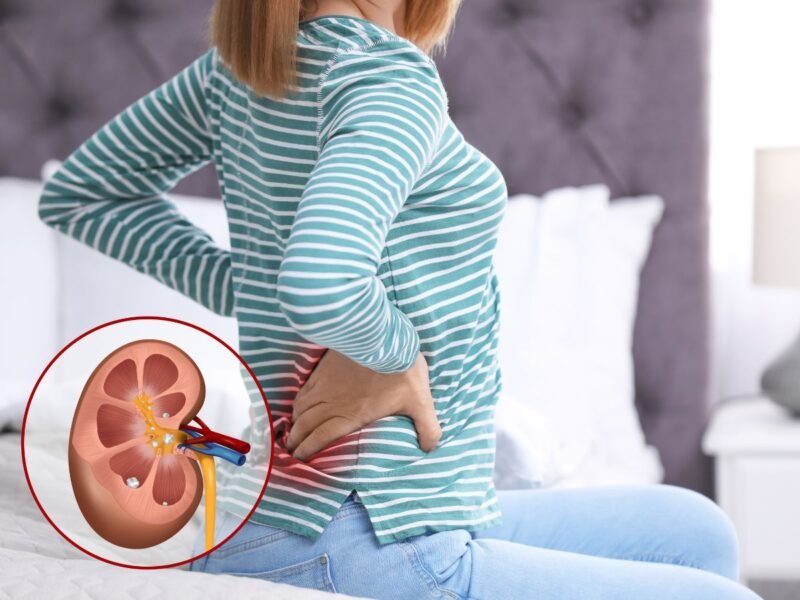 Kidney
