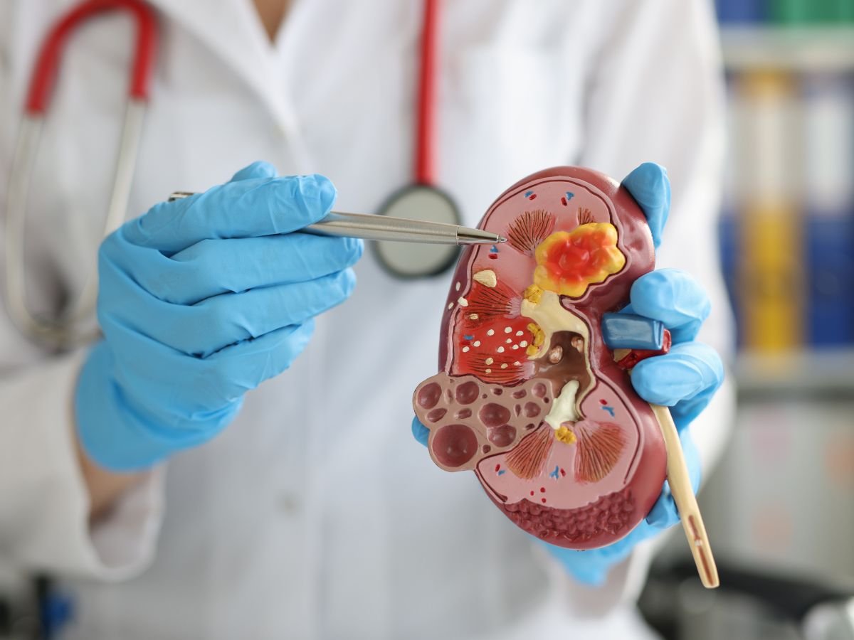 Kidney