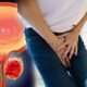 Prostate