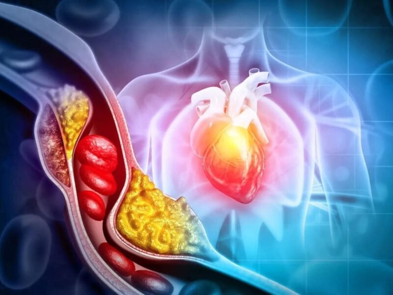 Cholesterol Levels