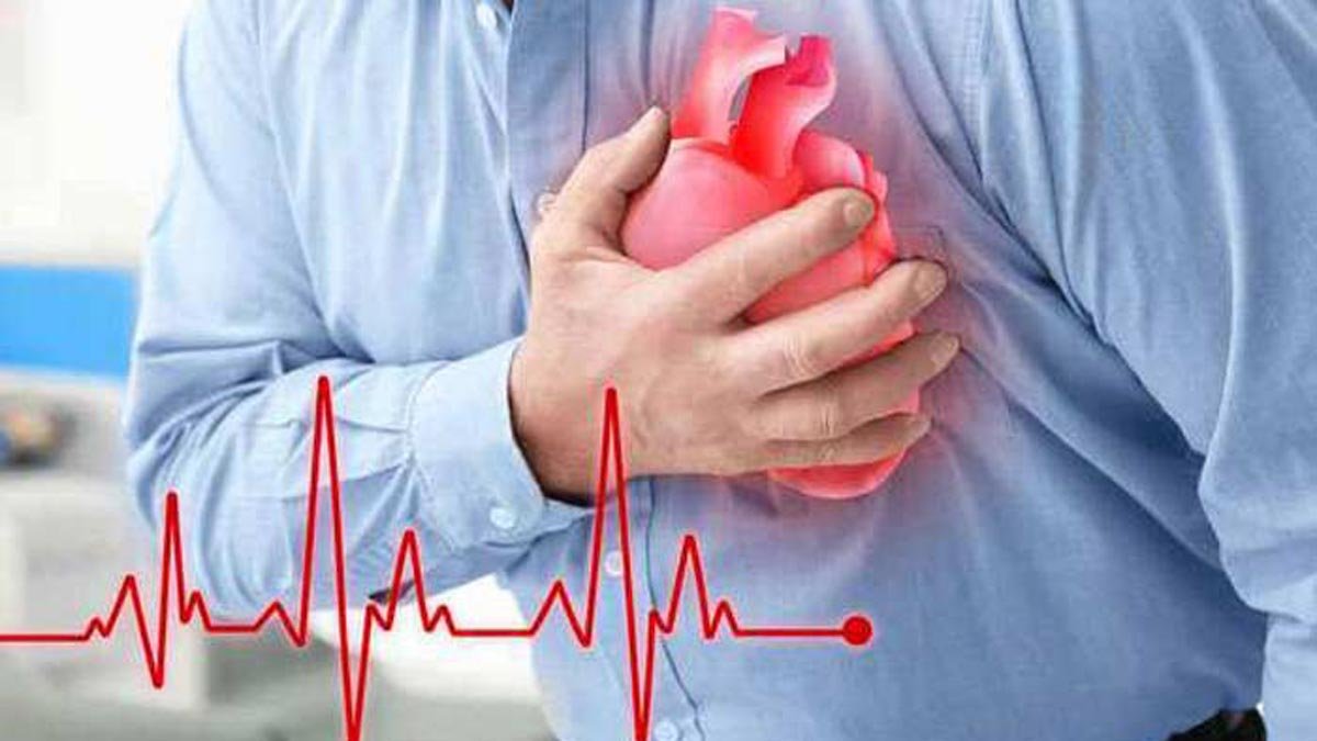 Heart Attack