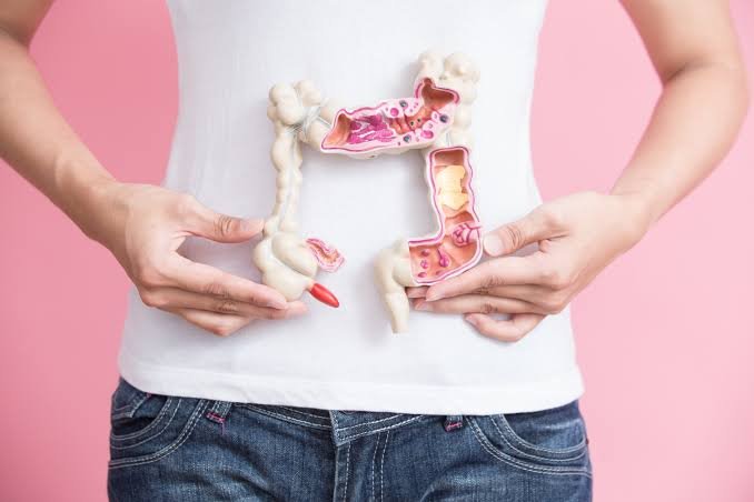 Colorectal Cancer
