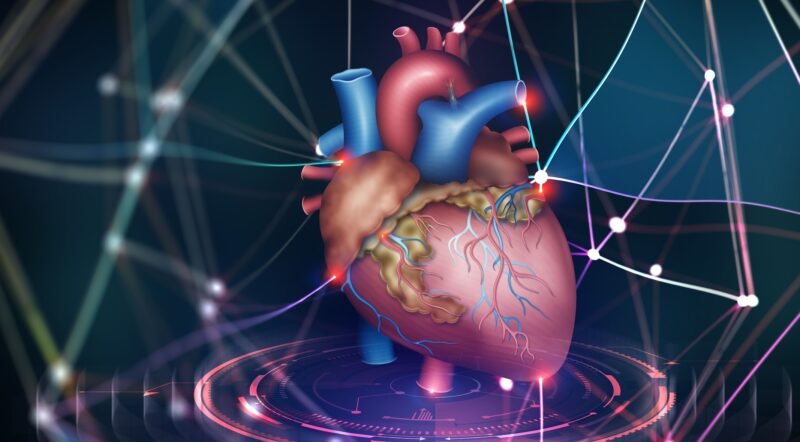 Heart Transplant