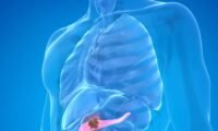 Pancreatic Cancer