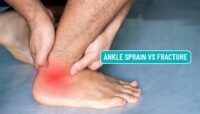 Sprain vs Fracture