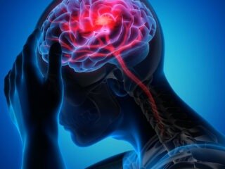 Signs of Stroke You Should Never Ignore